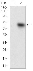 Anti-TIE1 Antibody (6A314)