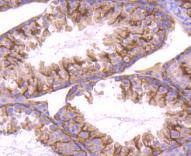 Anti-STIM1 Antibody (8E689)