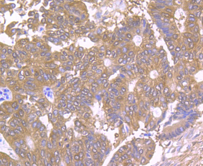 Anti-TCTP/TPT1 Antibody (7X932)