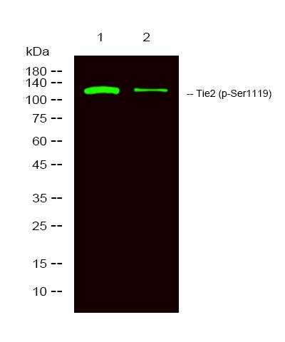 Anti-Phospho-TIE2 (Ser1119) Polyclonal Antibody