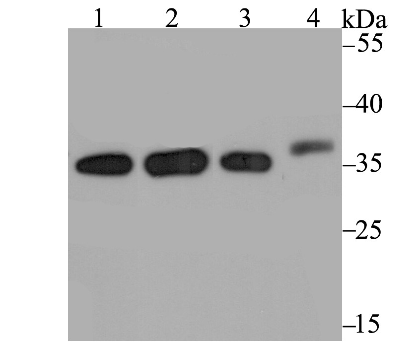 Anti-STUB1 Antibody (5M430)