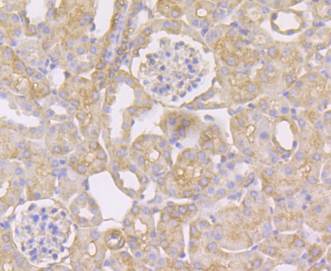Anti-STUB1 Antibody (5M430)