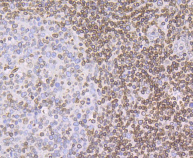 Anti-SUN2 Antibody (2Y616)