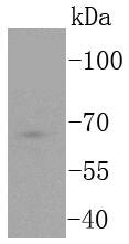 Anti-TCF7L2 Antibody (8D555)