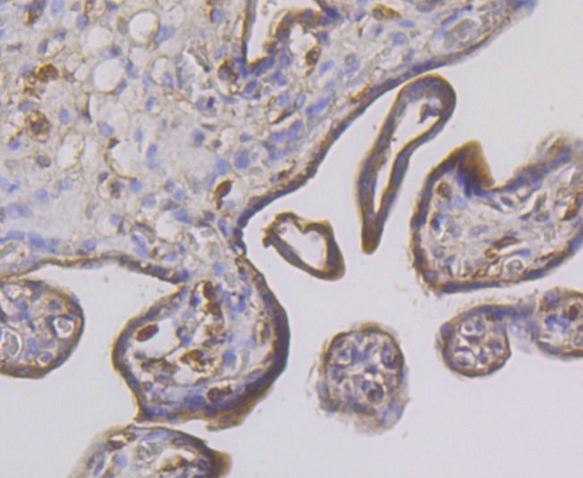 Anti-STUB1 Antibody (5M430)