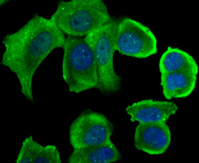 Anti-STUB1 Antibody (5M430)
