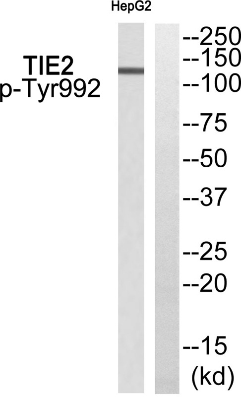 Anti-Phospho-TIE2 (Tyr992) Polyclonal Antibody