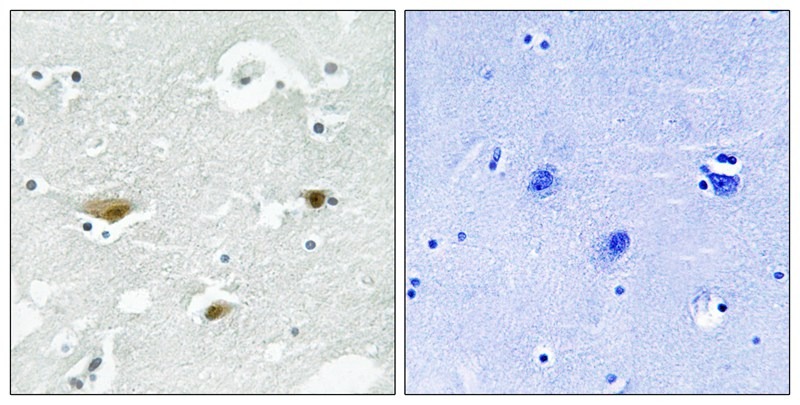 Anti-Phospho-STK39 (Ser323) Polyclonal Antibody