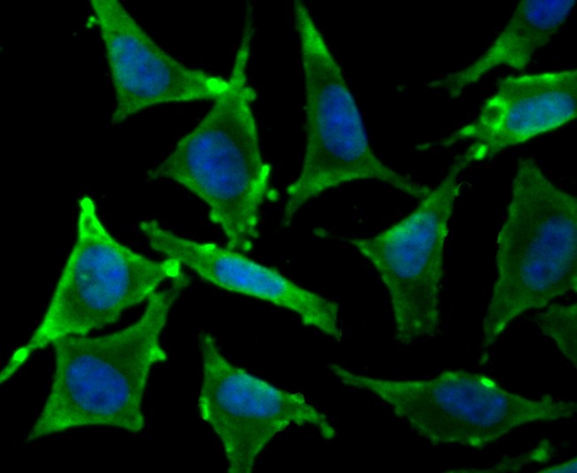 Anti-TCTP/TPT1 Antibody (7X932)