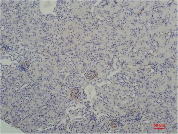 Anti-TBP Antibody (1C626)