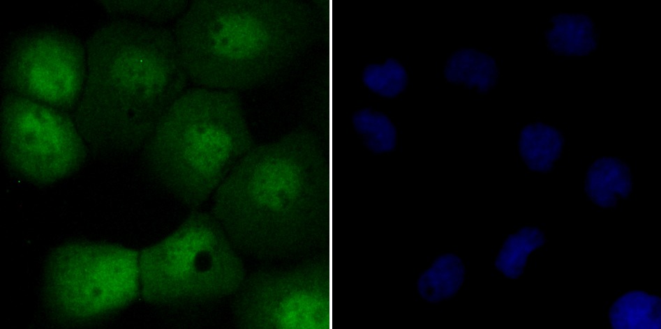 Anti-SUN1 Antibody (3B391)