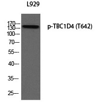 Anti-Phospho-TBC1D4 (Thr642) Polyclonal Antibody
