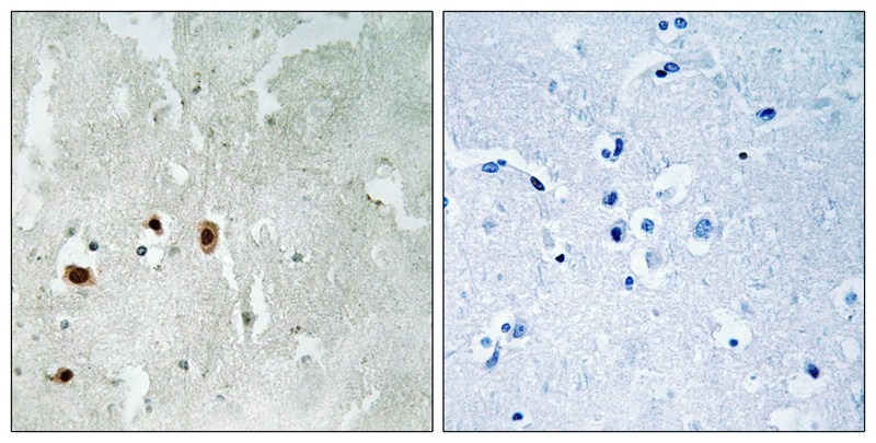 Anti-Phospho-KAT5 (Ser90) Polyclonal Antibody