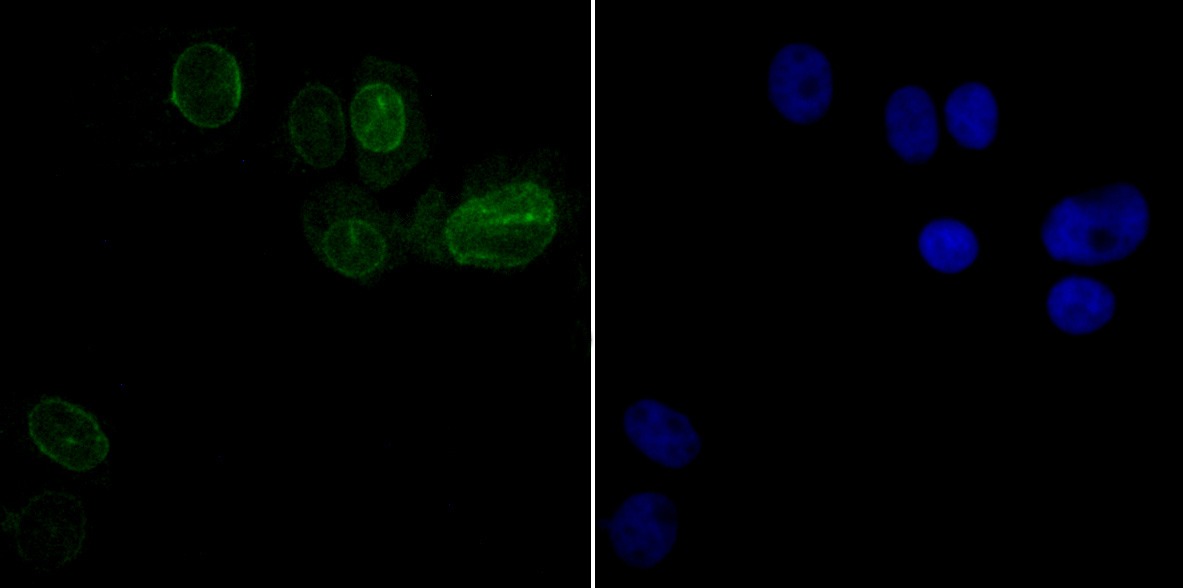 Anti-SUN2 Antibody (2Y616)