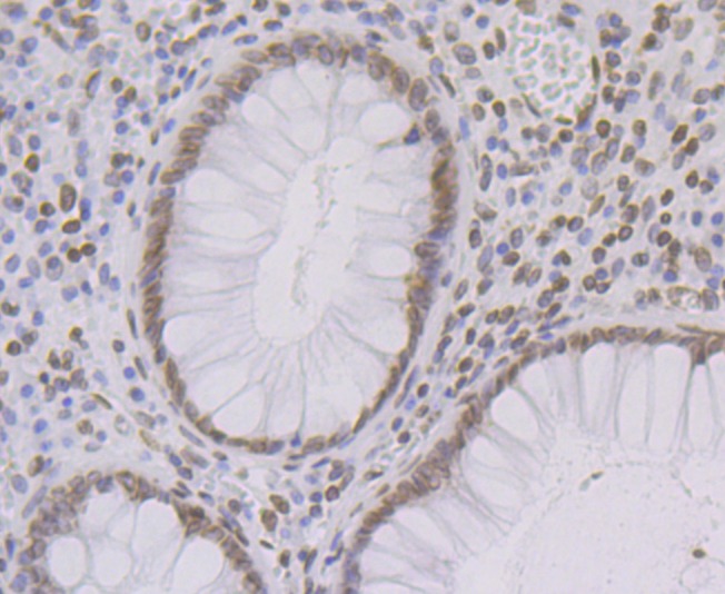 Anti-SUN2 Antibody (2Y616)