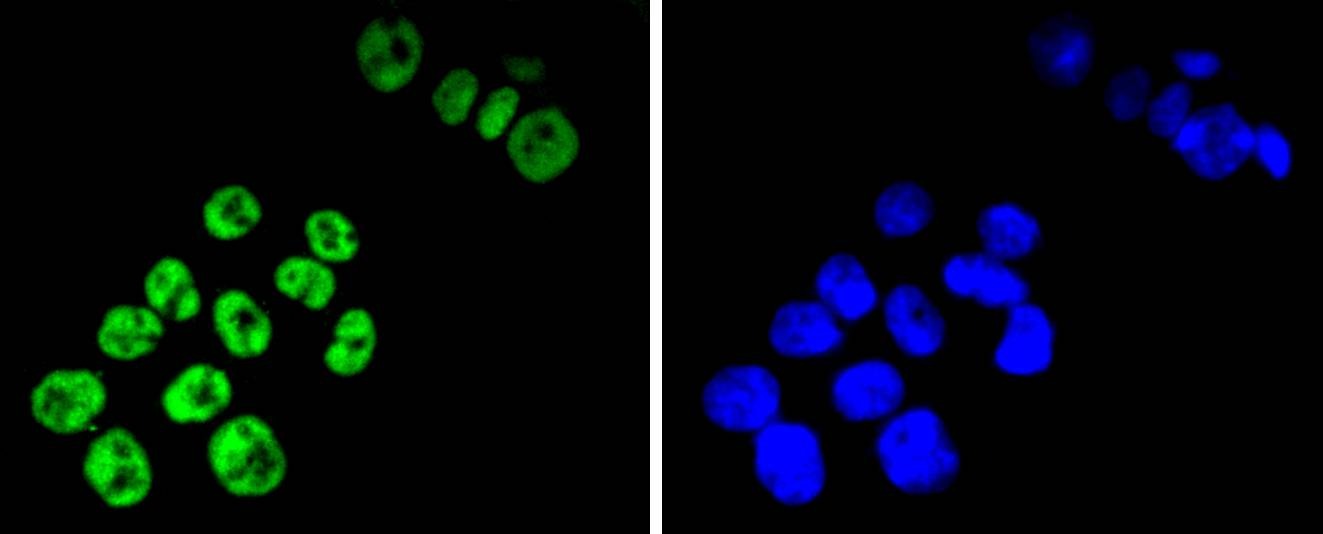 Anti-TCF7L2 Antibody (8D555)