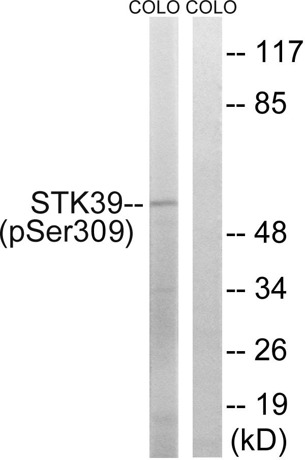 Anti-Phospho-STK39 (Ser309) Polyclonal Antibody