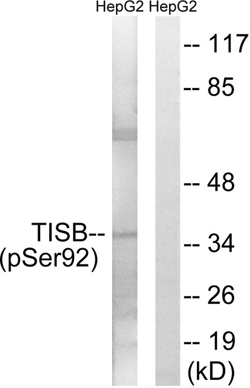 Anti-Phospho-TIS11B (Ser92) Polyclonal Antibody