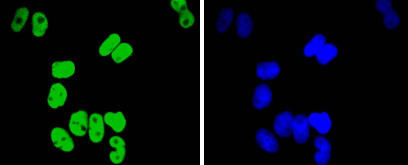 Anti-TCF7L2 Antibody (8D555)