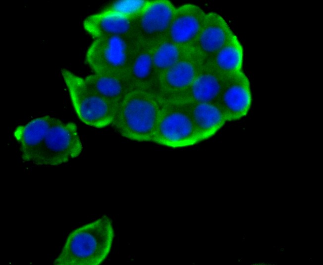 Anti-TCTP/TPT1 Antibody (7X932)