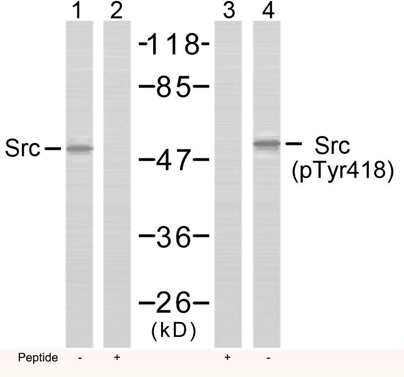 Anti-Phospho-Src (Tyr418) Polyclonal Antibody
