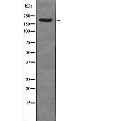 Anti-Phospho-SRC-1 (Thr1179) Polyclonal Antibody