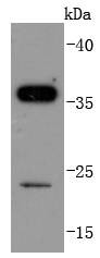 Anti-SIRT5 Antibody (7F77)