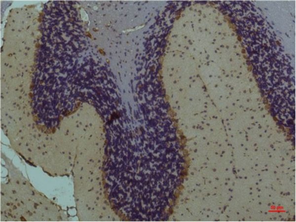 Anti-STAT3 Antibody (8P240)