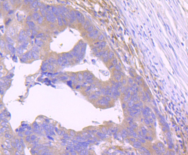 Anti-STAT2 Antibody (3V841)