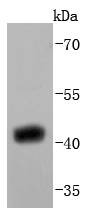 Anti-SIRT2 Antibody (4V247)