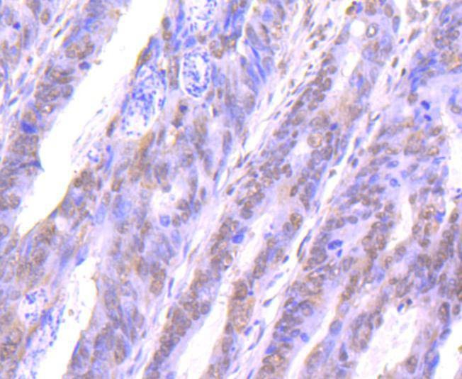 Anti-STAT4 Antibody (9R238)
