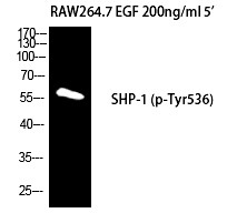 Anti-Phospho-SHP-1 (Tyr536) Polyclonal Antibody