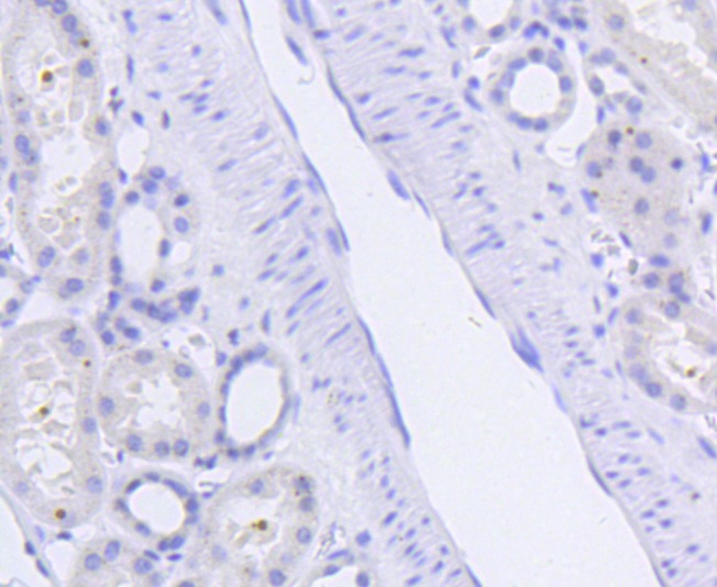 Anti-Phospho-SIRT1 (Ser47) Antibody (5Z724)
