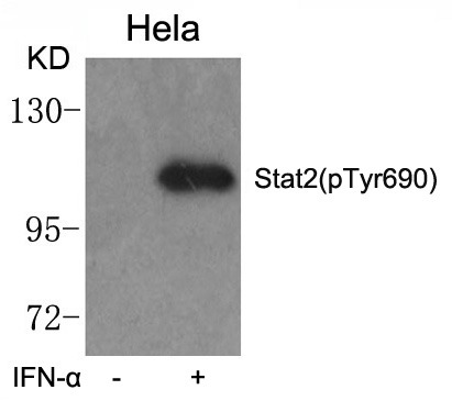 Anti-Phospho-STAT2 (Tyr690) Polyclonal Antibody 2