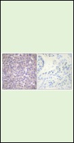 Anti-Phospho-SHP-1 (Tyr536) Polyclonal Antibody 2