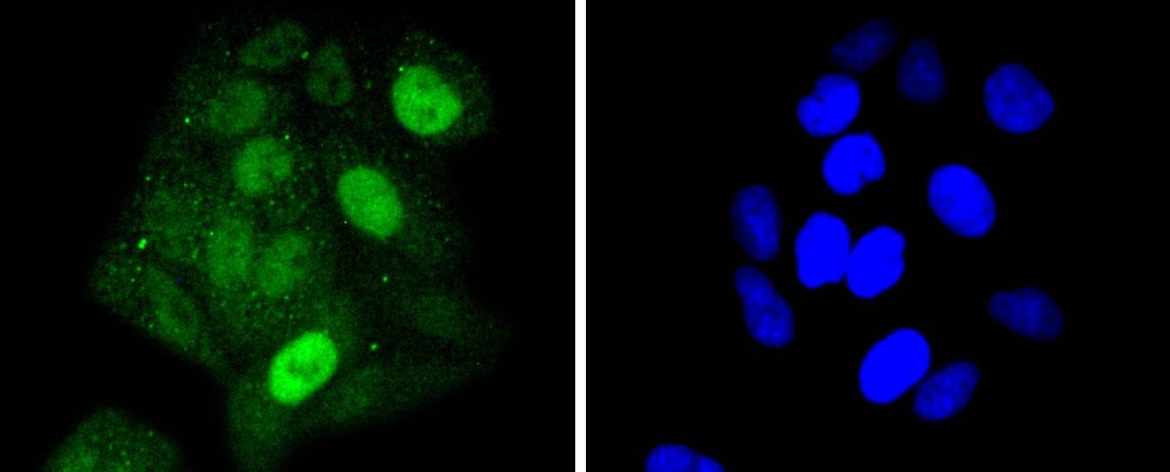 Anti-STAT5A Antibody (6E796)