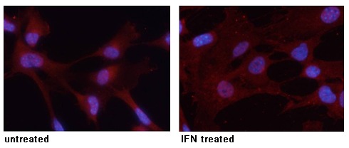 Anti-Phospho-STAT3 (Tyr705) Polyclonal Antibody 3