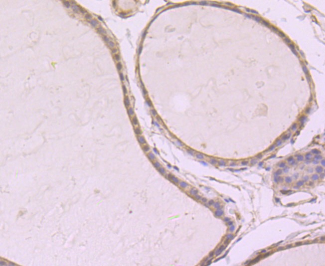 Anti-SRC-1 Antibody (5K128)