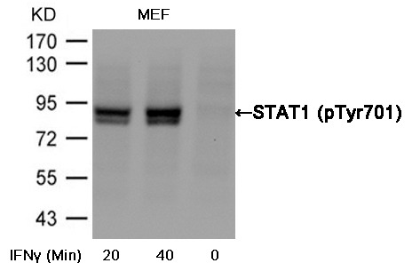 Anti-Phospho-STAT1 (Tyr701) Polyclonal Antibody 2