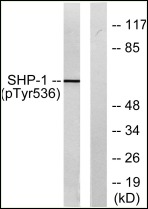 Anti-Phospho-SHP-1 (Tyr536) Polyclonal Antibody 2