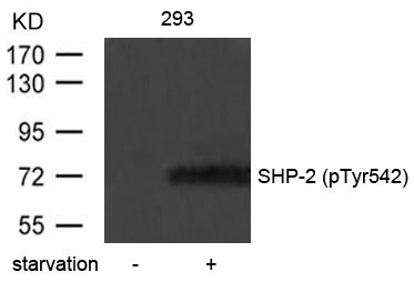 Anti-Phospho-PTPN11 (Tyr542) Polyclonal Antibody 2