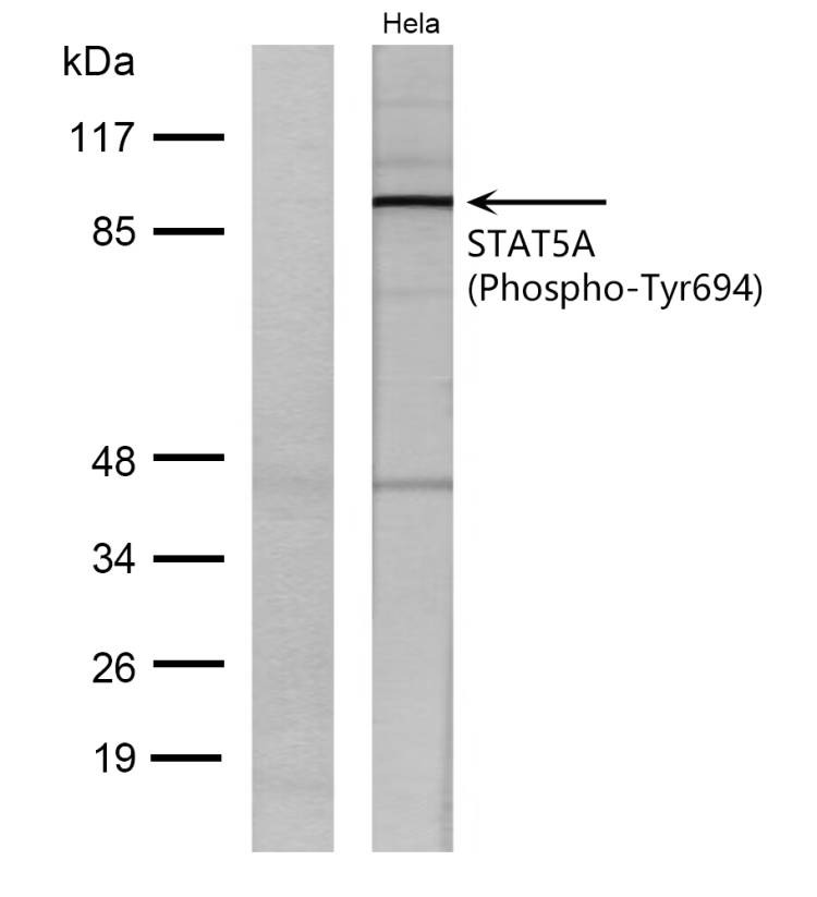 Anti-Phospho-STAT5A (Tyr694, 699) Polyclonal Antibody