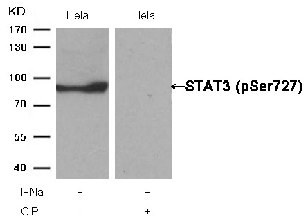 Anti-Phospho-STAT3 (Ser727) Polyclonal Antibody