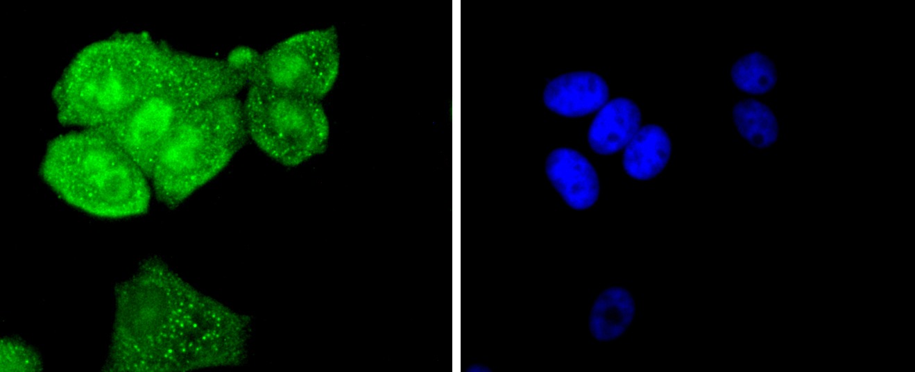 Anti-PTPN11 Antibody (1T267)