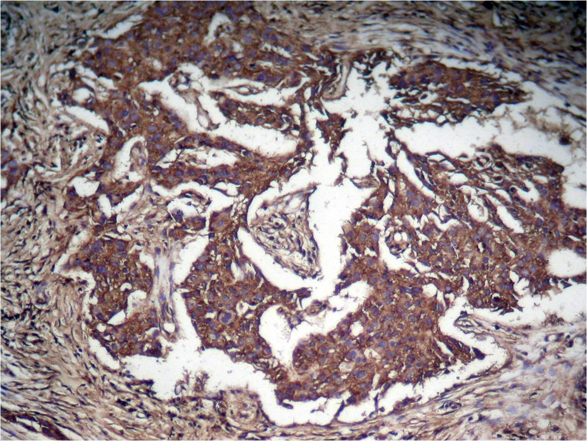 Anti-Phospho-STAT3 (Tyr705) Polyclonal Antibody 3