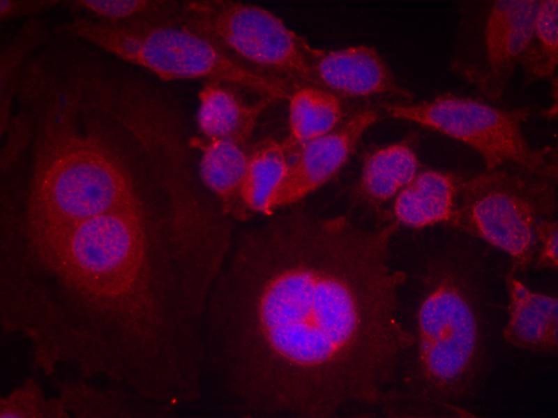 Anti-Phospho-STAT3 (Ser727) Polyclonal Antibody