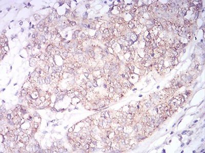 Anti-SK2 Antibody (4K957)