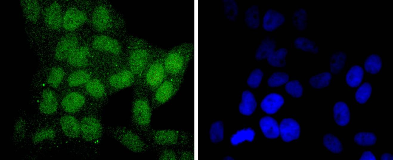 Anti-SIRT6 Antibody (6U297)