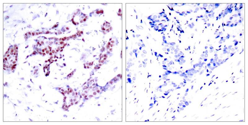 Anti-Phospho-STAT1 (Tyr701) Polyclonal Antibody 2