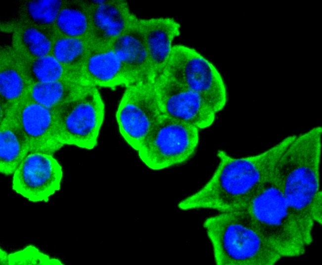 Anti-Phospho-SIRT1 (Ser47) Antibody (5Z724)